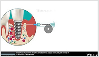Infographic Creation